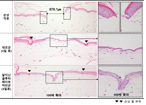 LG생활건강이 개발한 손상 피부 회복 성분인 ‘알지닌 글루타메이트‘가 화상 환자의 피부 건조함과 가려움을 의학적으로 개선하는데 도움이 되는 것으로 입증됐다. 사진/LG생활건강